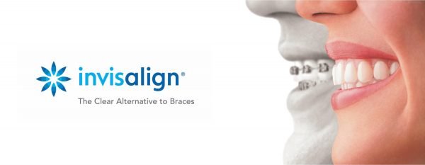Invisalign West Hollywood