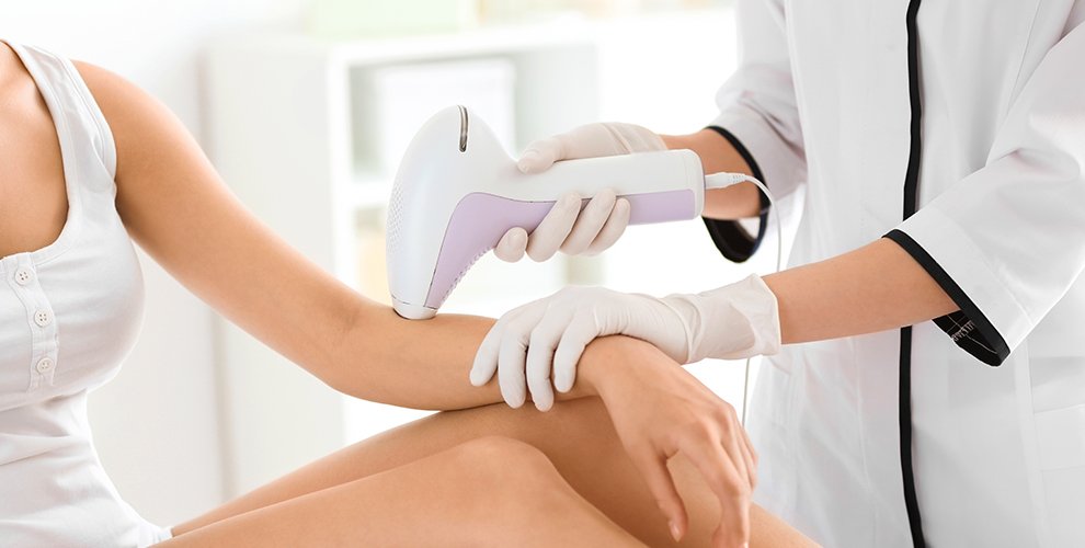 Laser Hair Removal
