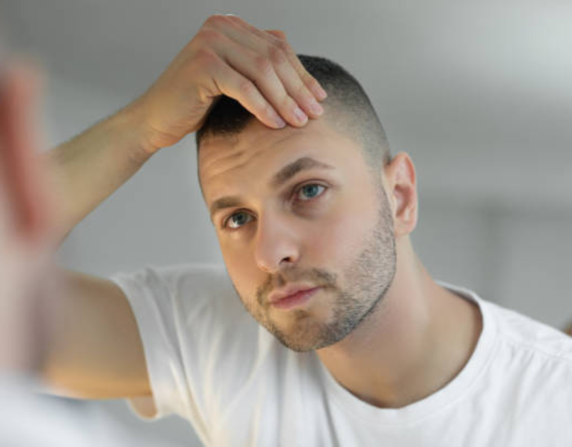 hair loss pills